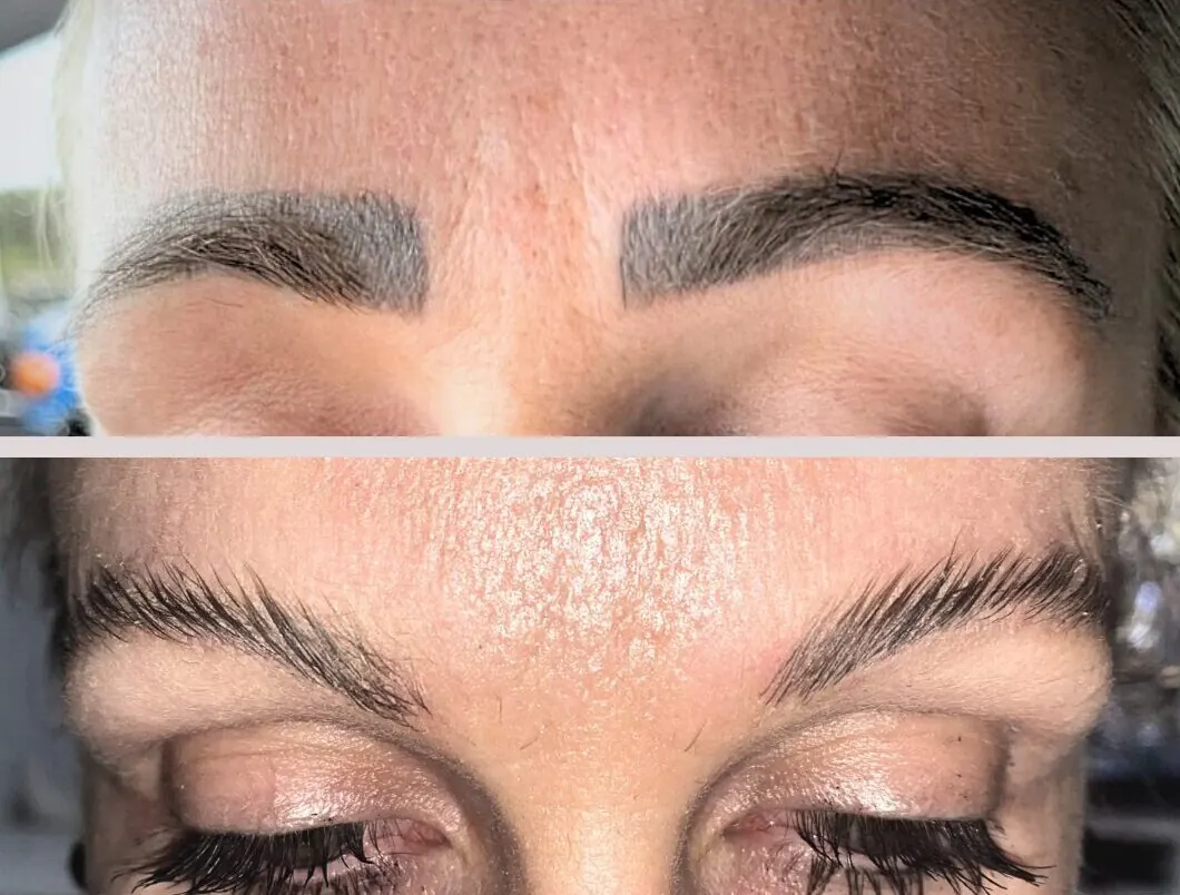 Tattooed eyebrows before, natural brows after removal