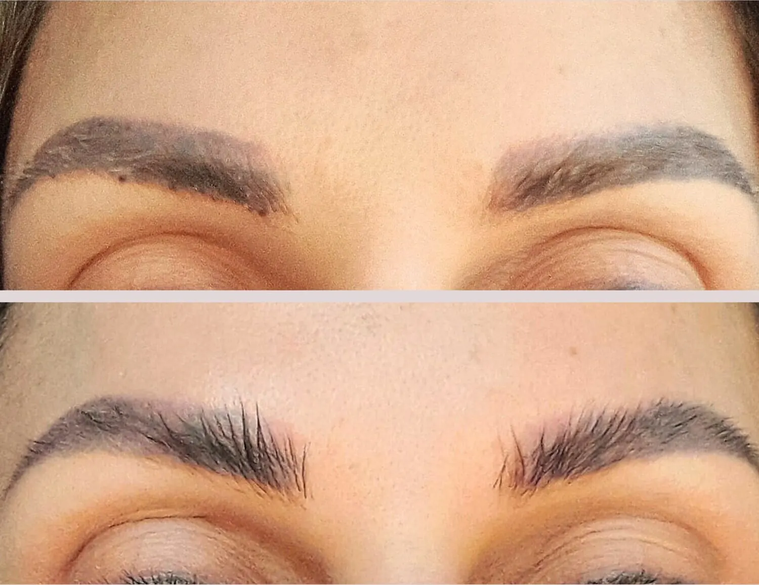 Tattooed eyebrows before, natural brows after removal