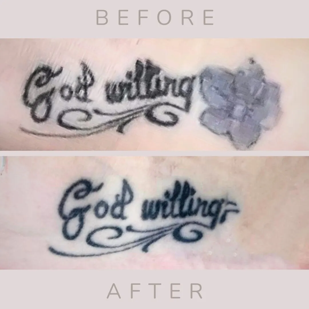 Script tattoo before, and the flower beside it gone after