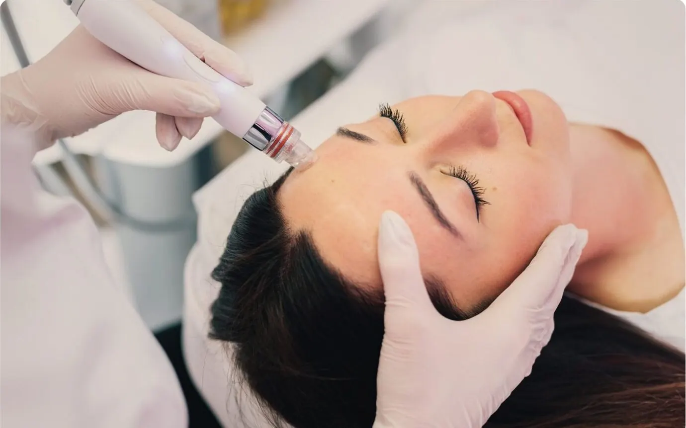 Skin needling pen on a forehead
